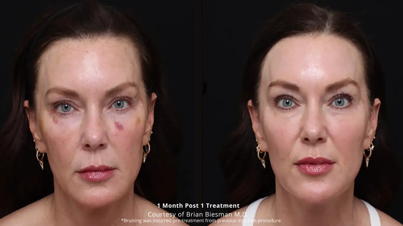 Laser-Green-Testimonial-Instagram-Post-300-×-300-px-1360-×-765-px-17-1
