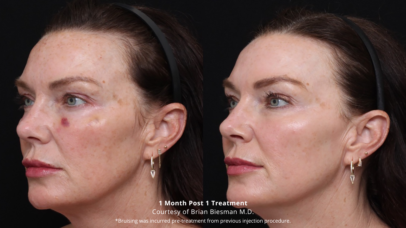 Laser-Green-Testimonial-Instagram-Post-300-×-300-px-1360-×-765-px-18-1